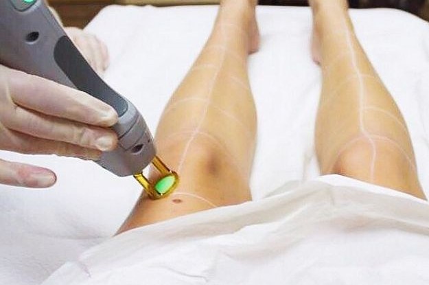 Laser Hair Removal  Greenville SC  Advanced Cosmetic Surgery