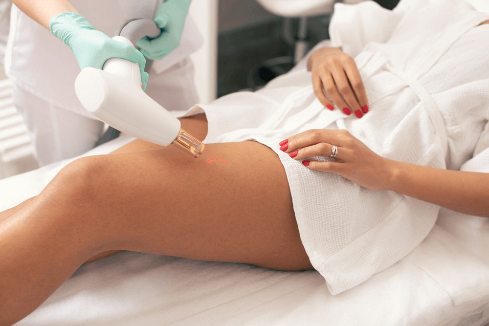 laser stretch mark treatment in navi mumbai