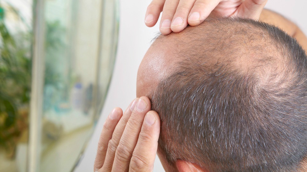 adult derived stem cell therapy for hairloss treatment in navi mumbai