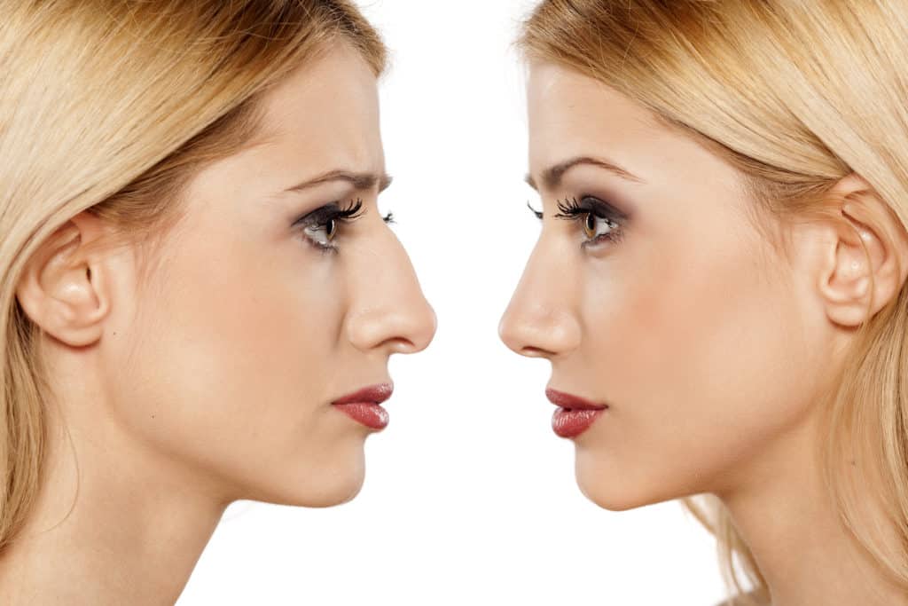 reconstructive plastic surgery in navi mumbai